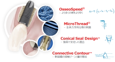 新世代のインプラント | 大阪市のインプラント歯科医院｜アーティ