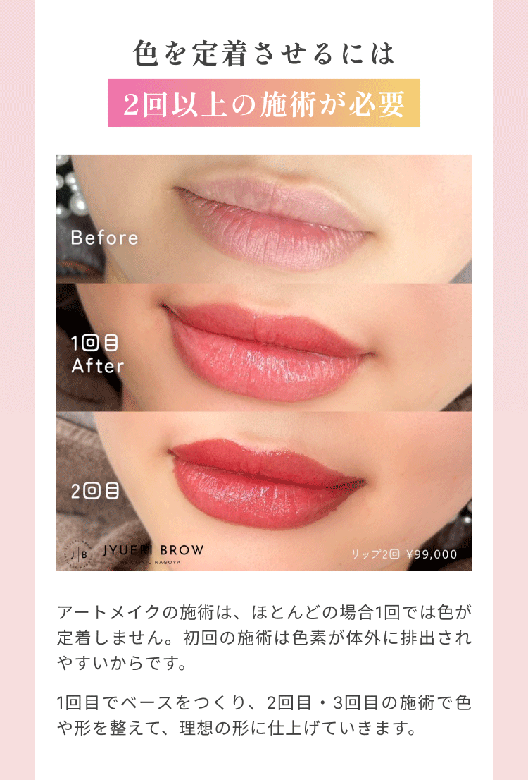 アートメイクの基礎知識｜ザ・クリニック名古屋