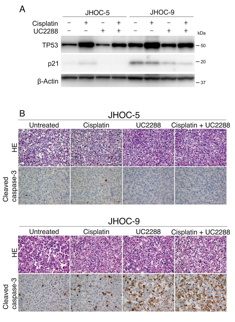 High Expression of p21 as a Potential Therapeutic Target in