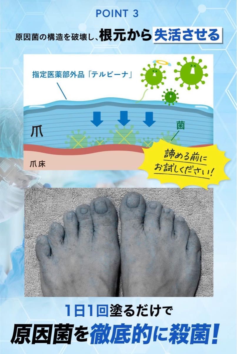 爪ケアに革命を 】TERBIINA テルビーナ 20g｜Yahoo!フリマ（旧PayPay