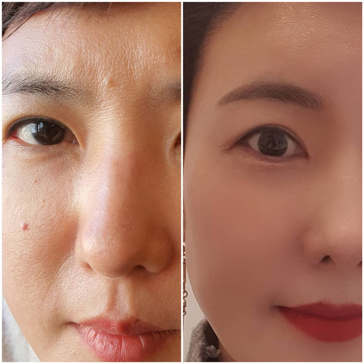 新品正規品]リニューアルのインセルダム3点セット｜Yahoo!フリマ（旧