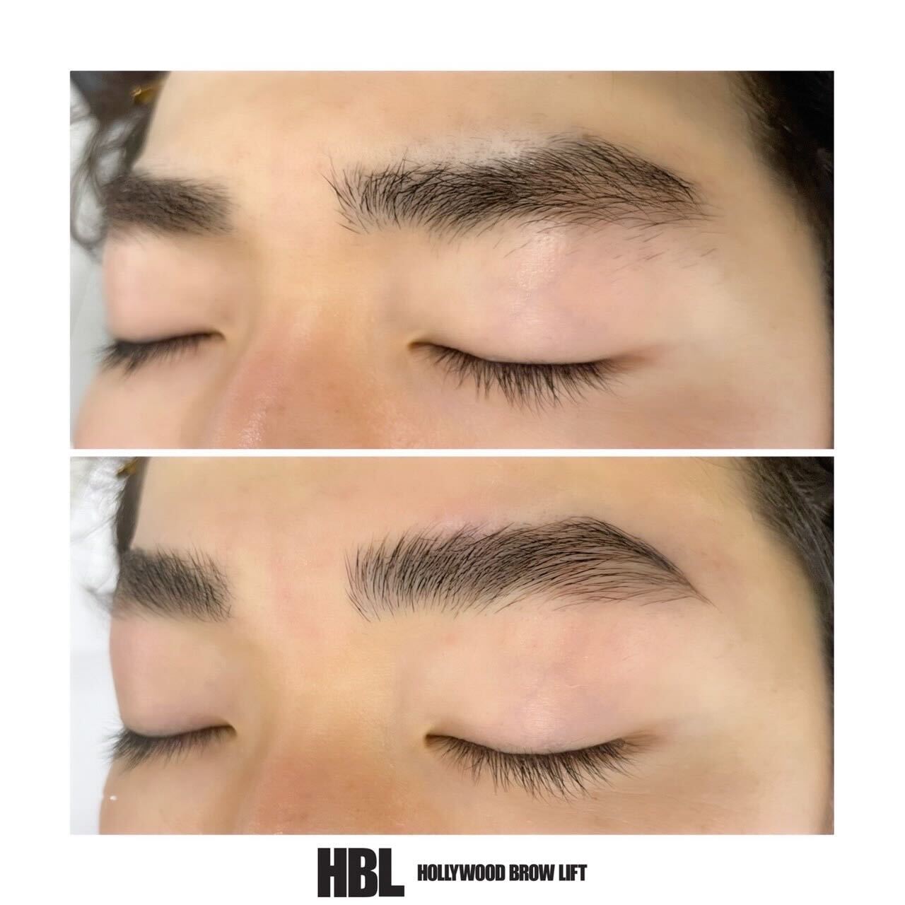 Hollywood Brow Lift – bcool