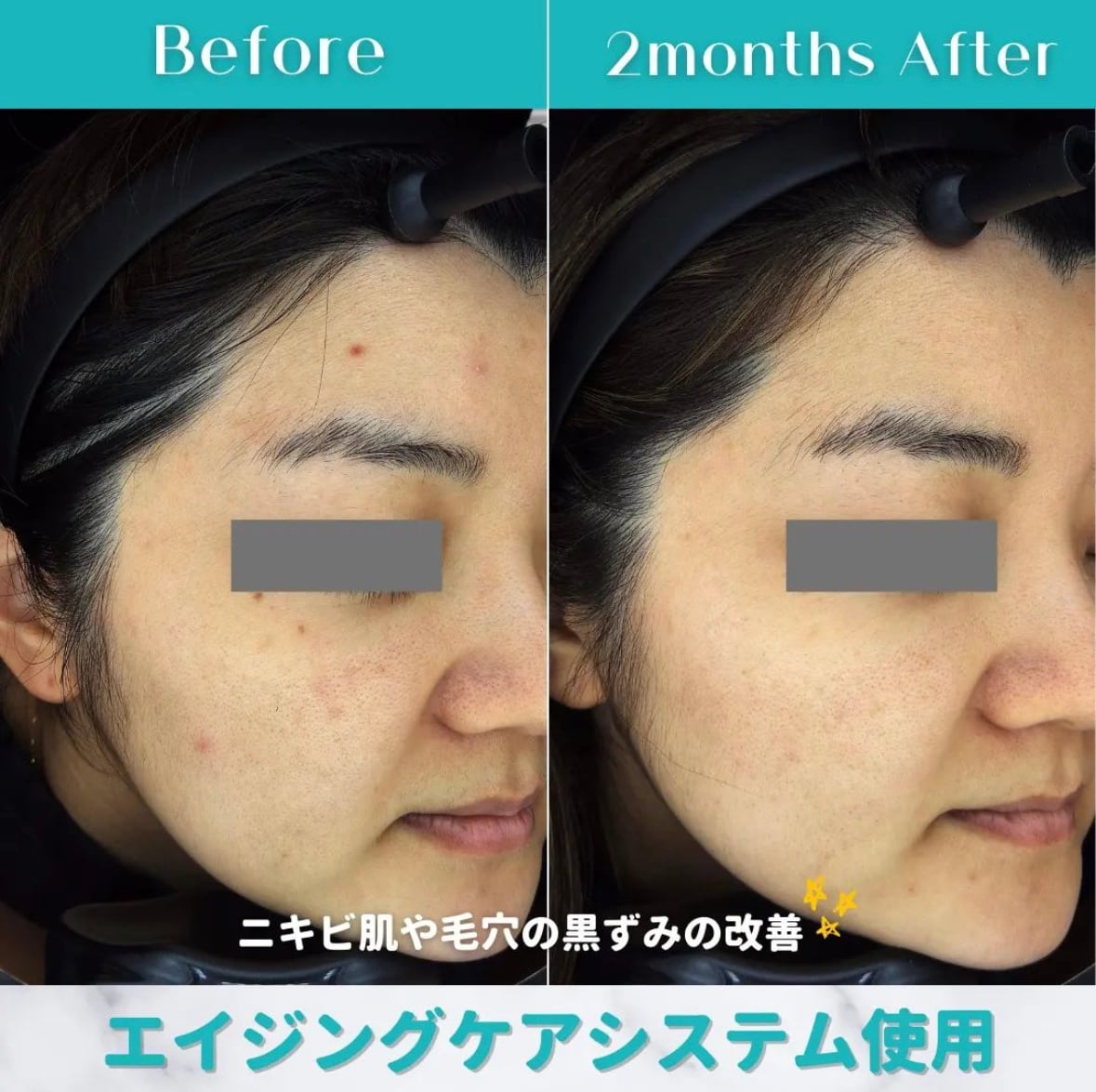 エイジングケア・アドバンスセット・ジャンマリーニ | dr.label