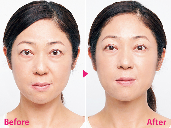 美容液を導入できる【美顔器】の実力は？53歳読者のビフォーアフター