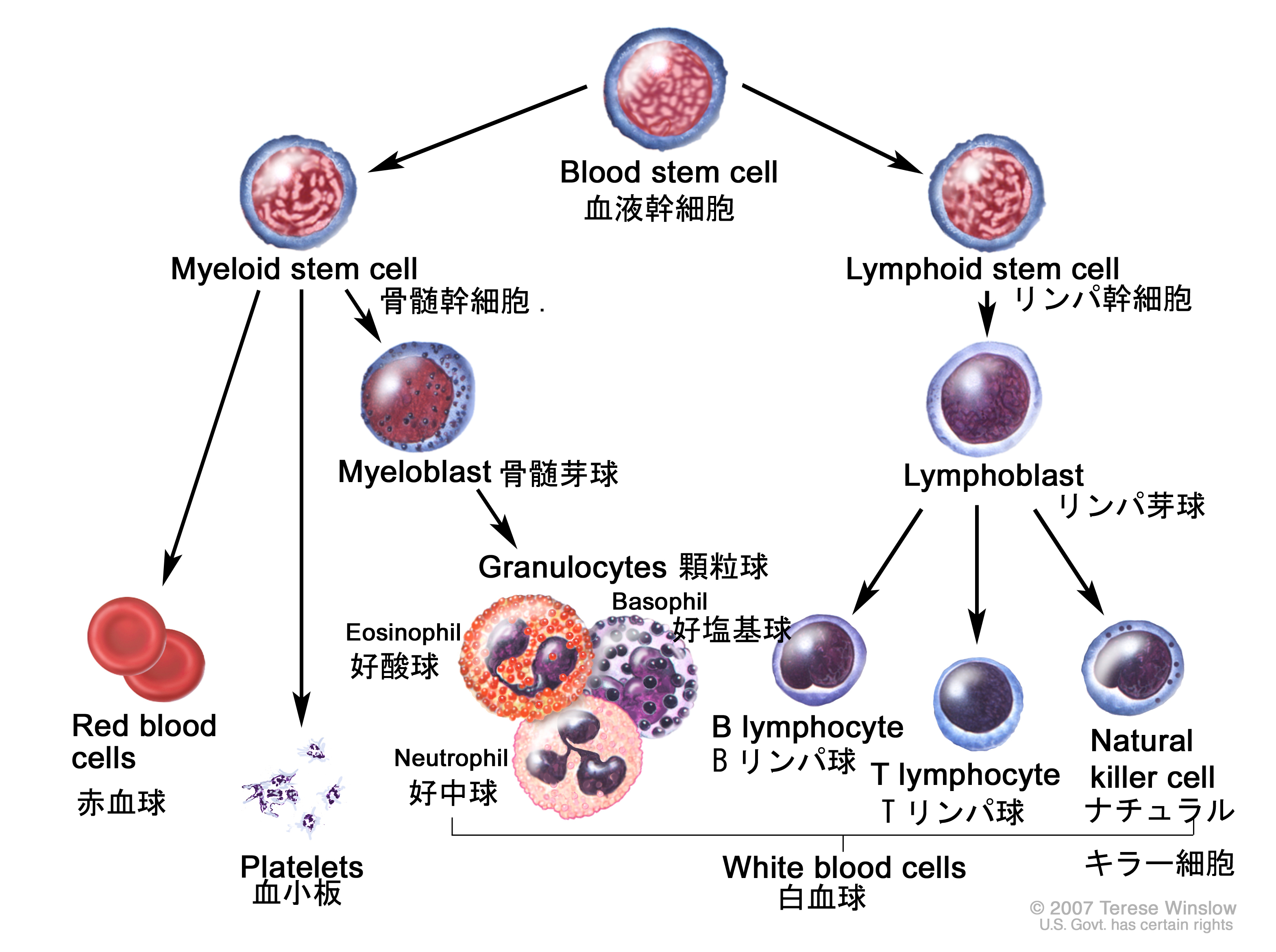 がん情報サイト | がん情報各論：[患者さん向け]小児急性骨髄性白血病
