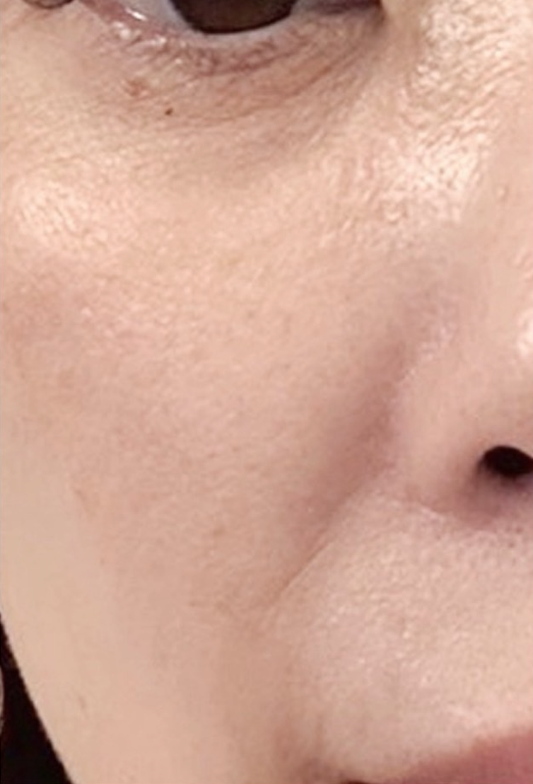 リフティングセラム＆クリームセット – GRATiAE