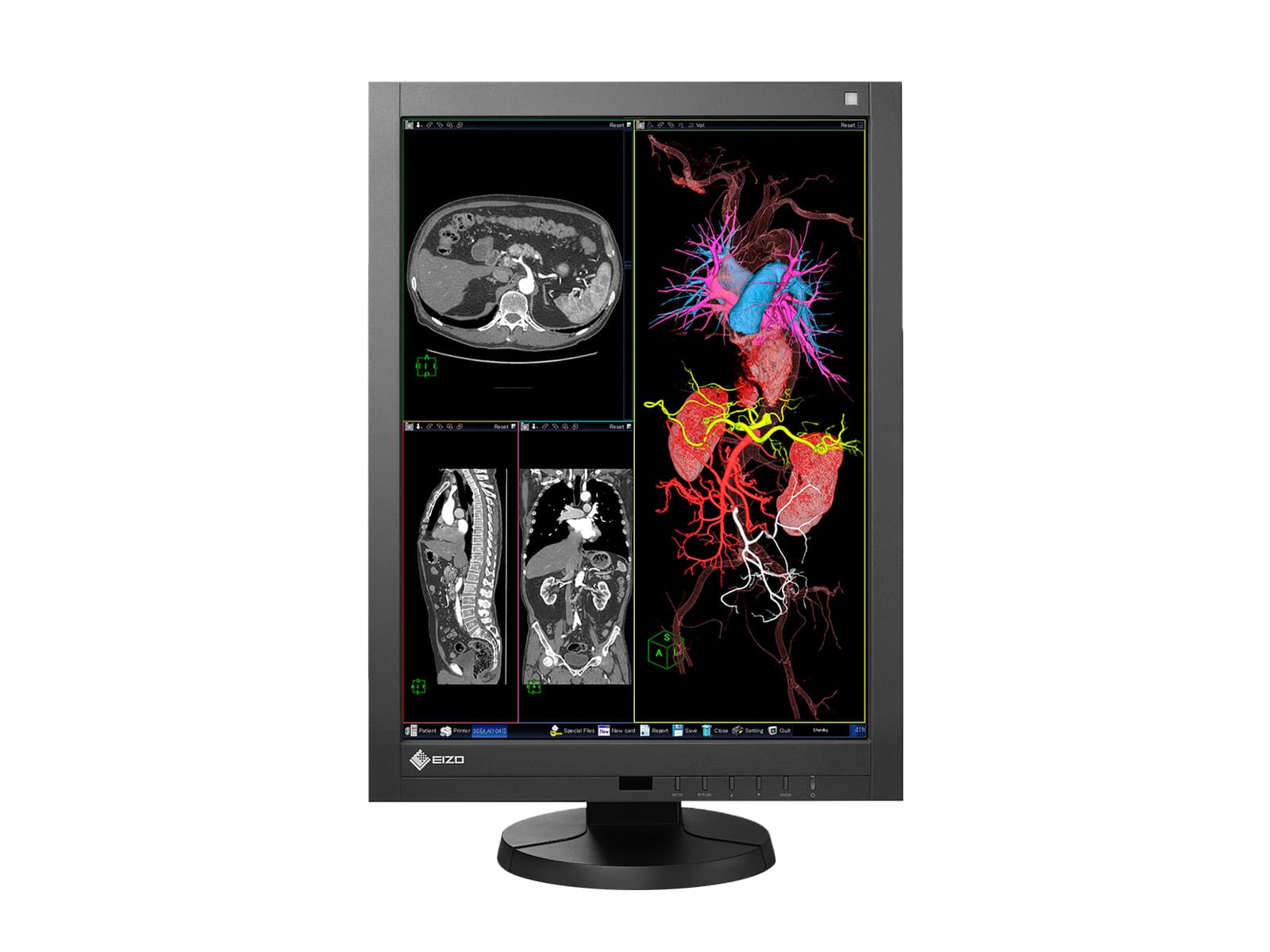 Eizo Radiforce RX240: 21