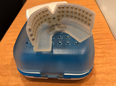 スマイルプロ｜歯列矯正ポータルサイトTheOrtho（ジ・オルソ）