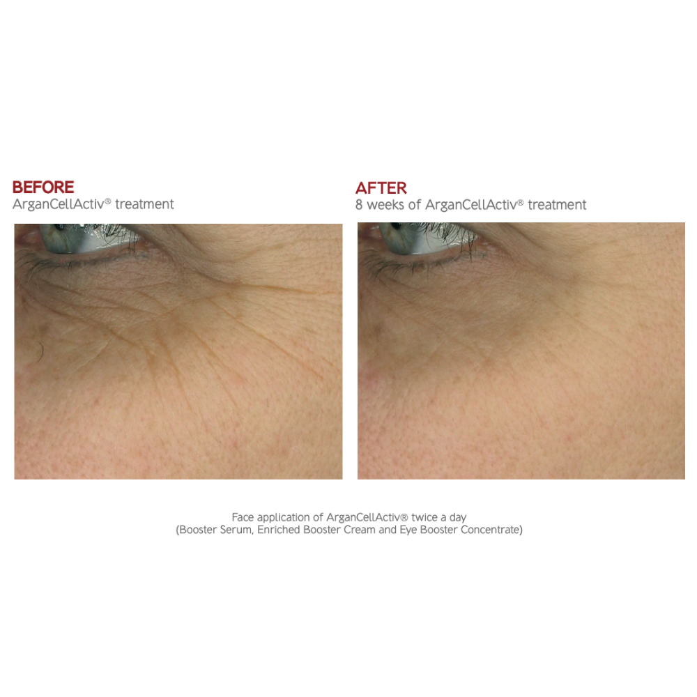 Dr. Levy Intense Stem Cell Booster Serum | Luxury Swiss Anti