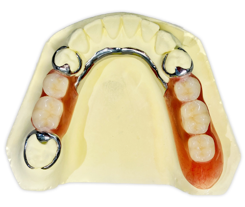 歯科技工物/デンチャー | 歯科技工所 コットンテール