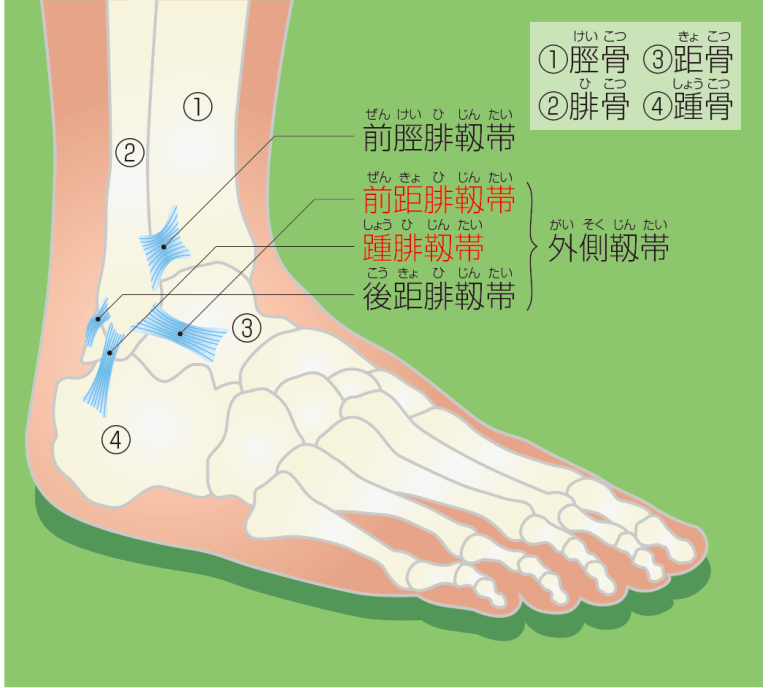 足関節捻挫の原因・症状・治療 - 足立慶友整形外科