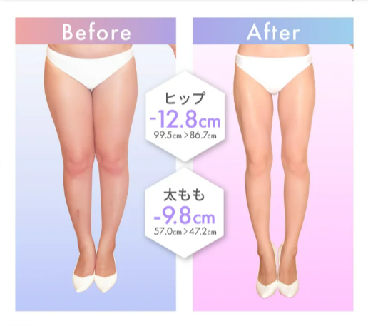 ラ・パルレの痩身エステに関する口コミ・評判！脚痩せエステや脂肪冷却