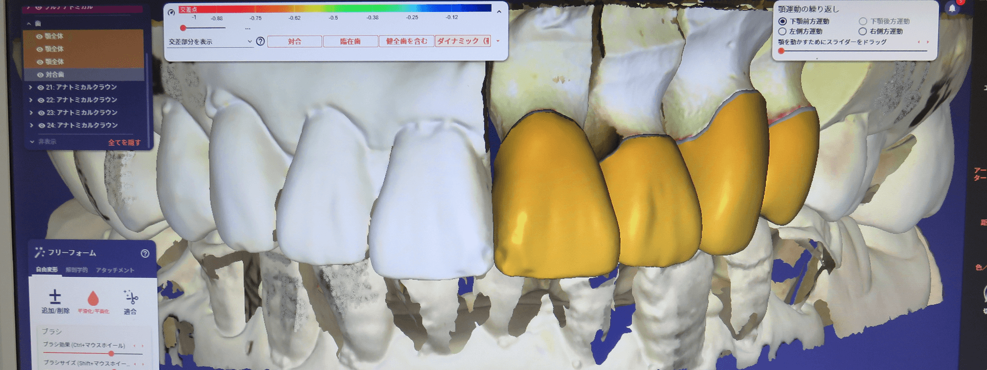 ARITAセラミックスラボラトリー｜福岡県北九州市の歯科技工