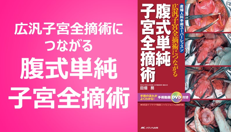 腹式単純子宮全摘術｜動画ライブラリ