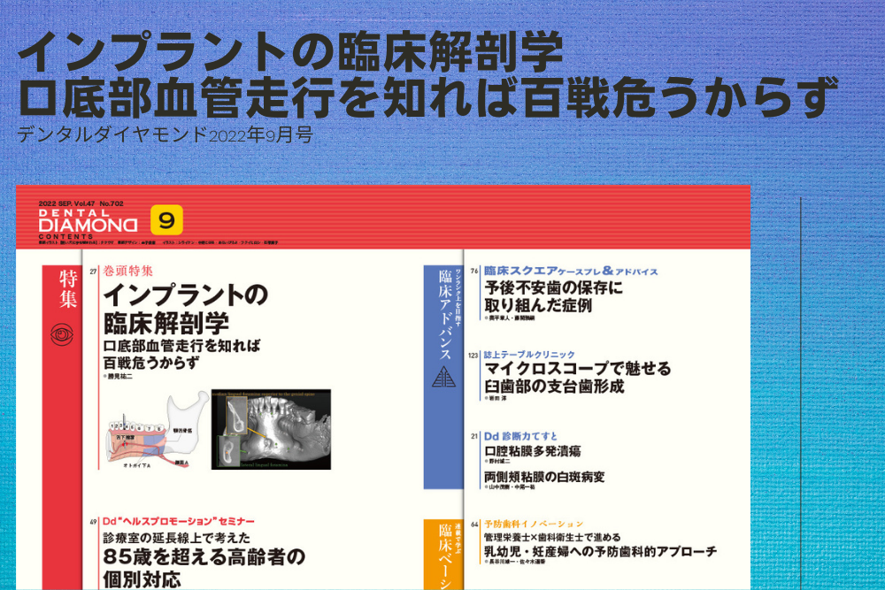 インプラントの臨床解剖学｜デンタルダイヤモンド2022年9月号 - 歯科