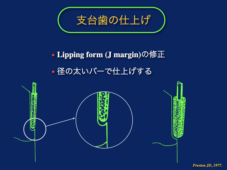 速く・上手に！誰でもできる支台歯形成テクニック | 株式会社 医療情報