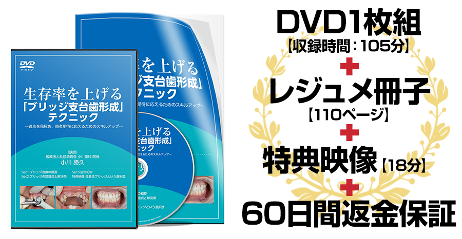 株式会社 医療情報研究所 | 生存率を上げる「ブリッジ支台歯形成