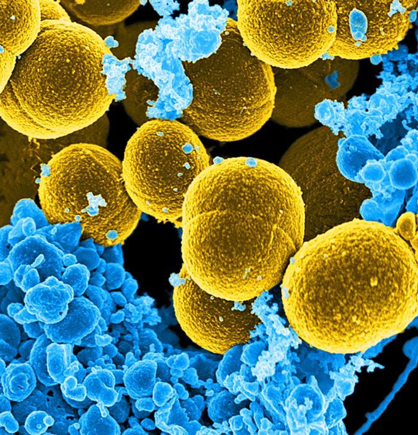 A Potential Antibiotic Emerges from Microbial 'Dark Matter