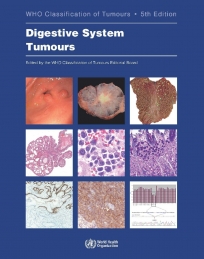 WHO Classification of Tumours, 5th ed., Vol.1 Digestive System