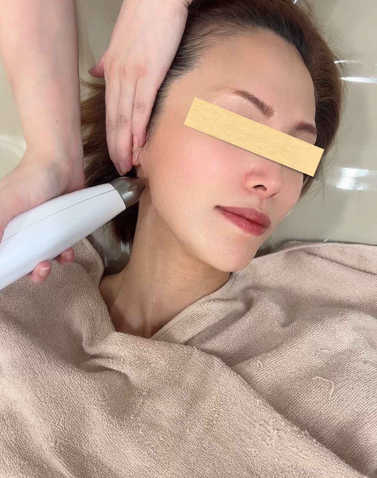 速攻小顔”を実感！針を使わずに美容液を肌の奥深くへ「ディープ