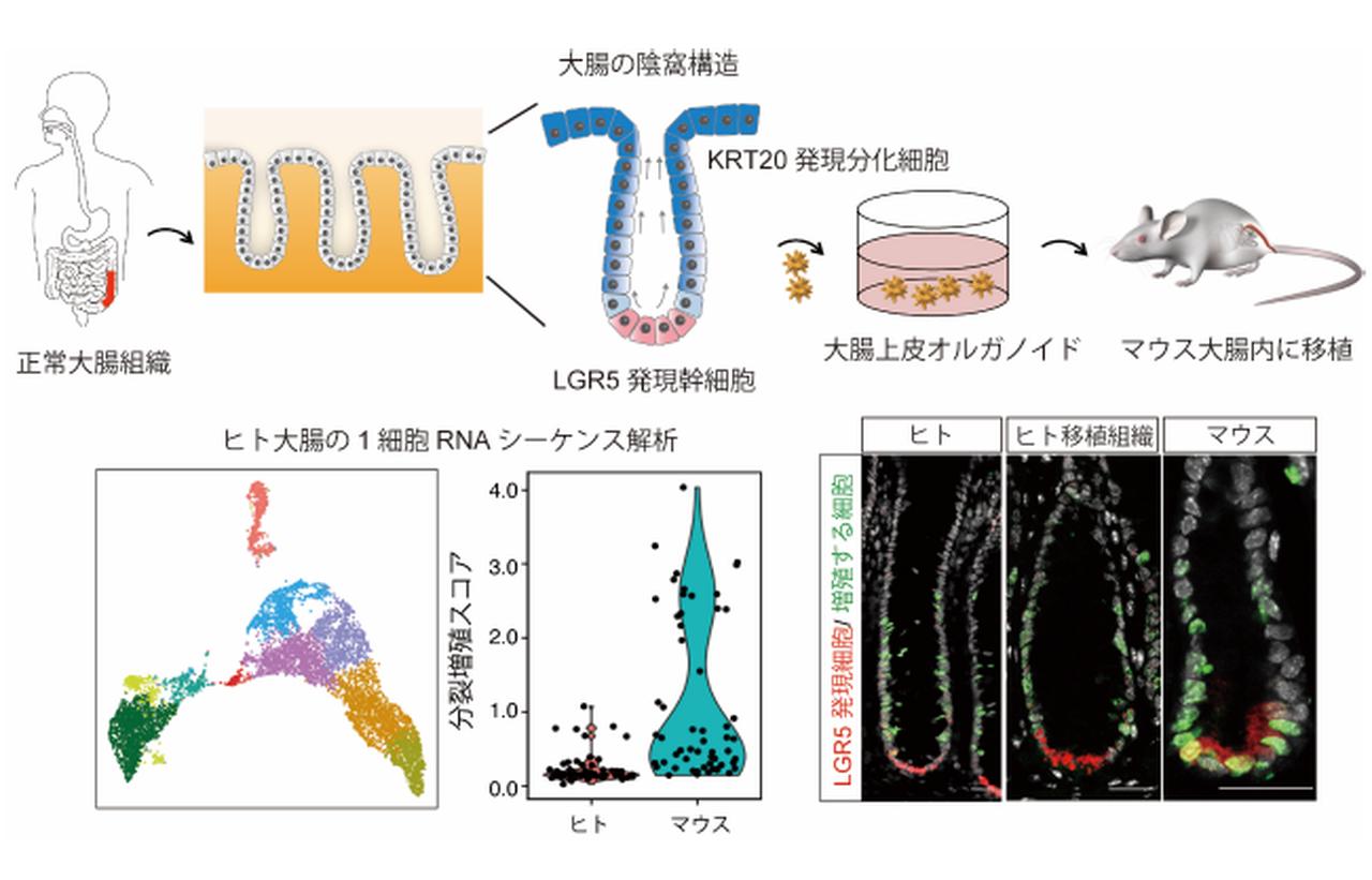 ヒト大腸の幹細胞は多くが「休止期」と判明、がんになりにくい仕組みに