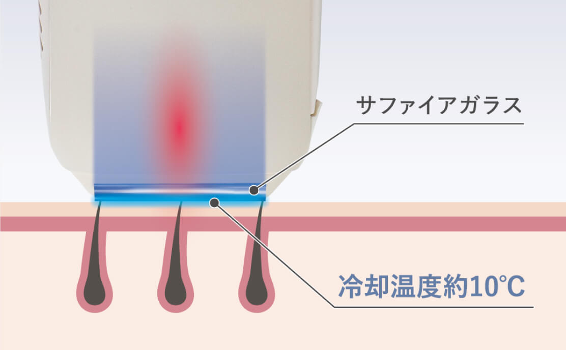 Thaleia（タレイア）｜ 光美容器 TLA-HR01IV