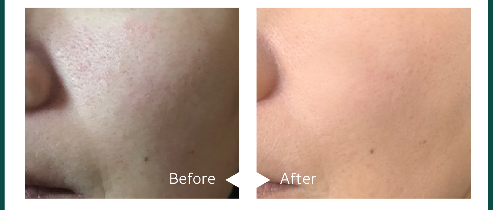 ZAC PACK｜DOC Skincare｜肌のチカラを高め、肌を育む。自宅でできる高