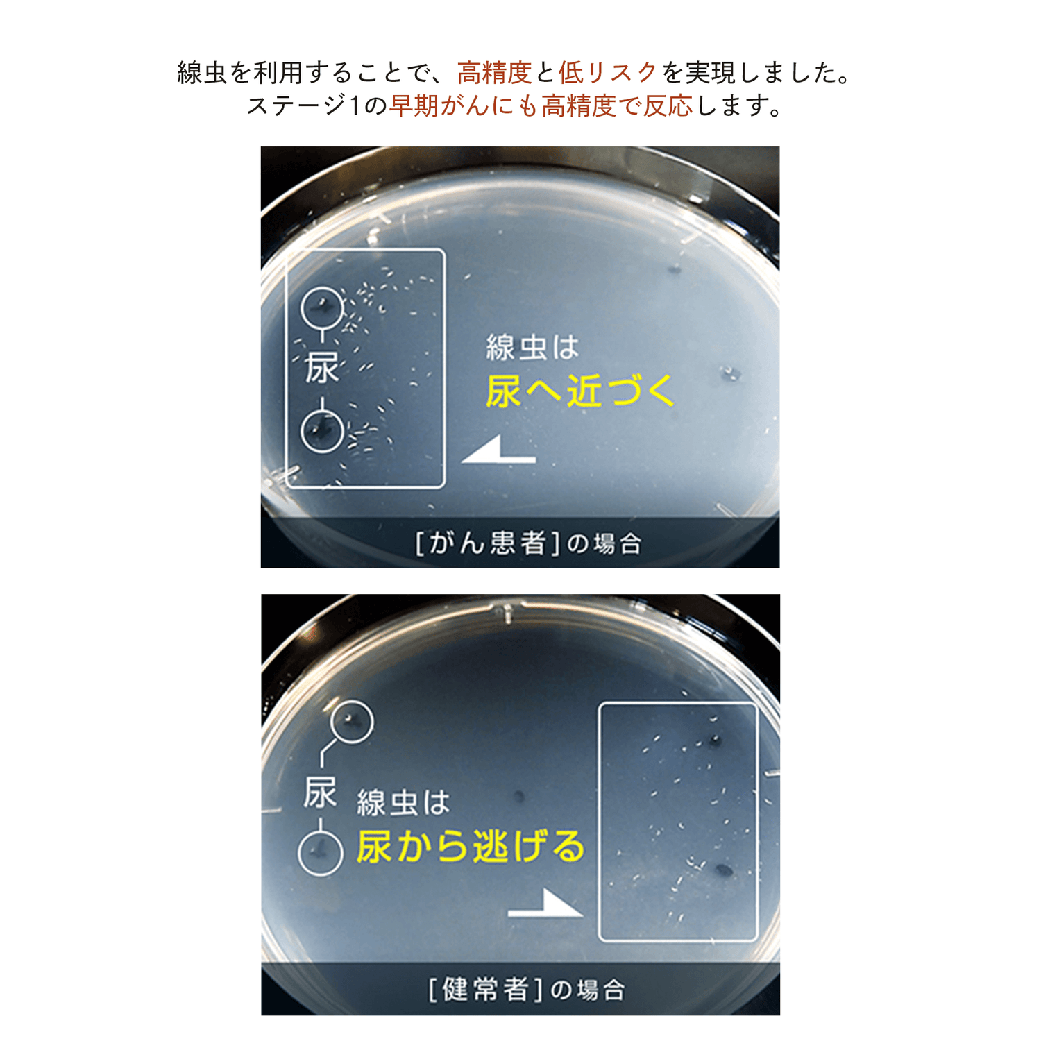 自宅で尿を採るだけ がんリスク検査 線虫 N-NOSE がん検査キット