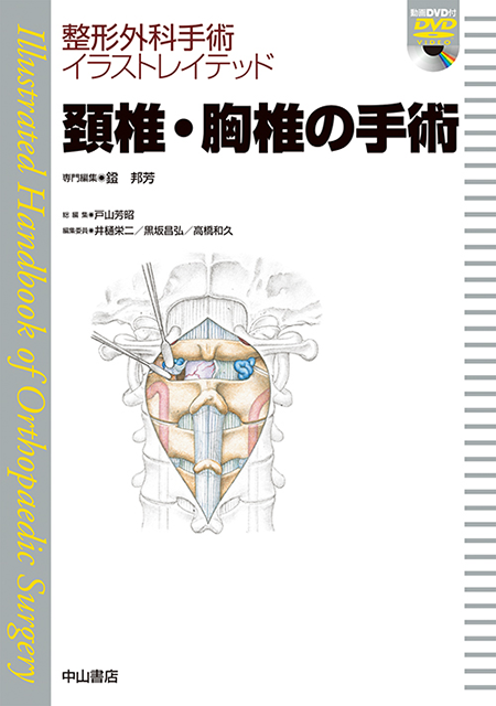 m3電子書籍 | 整形外科手術イラストレイテッド 頚椎・胸椎の手術［動画