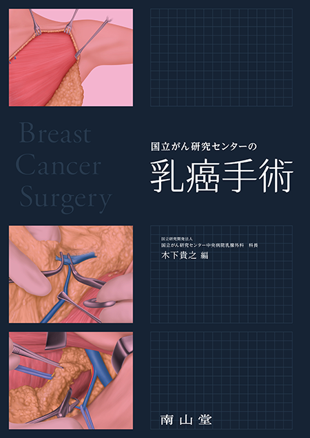 m3電子書籍 | 国立がん研究センターの乳癌手術