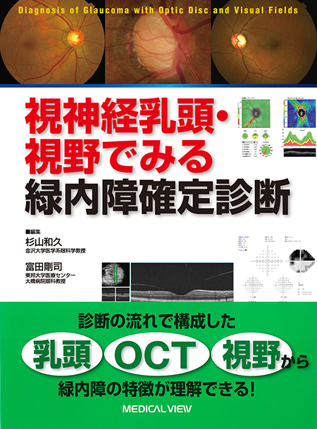 m3電子書籍 | 眼手術学 7 網膜・硝子体I