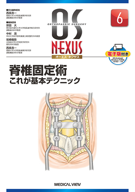 m3電子書籍 | OS NEXUS14 脊椎手術と合併症 回避の技とトラブル