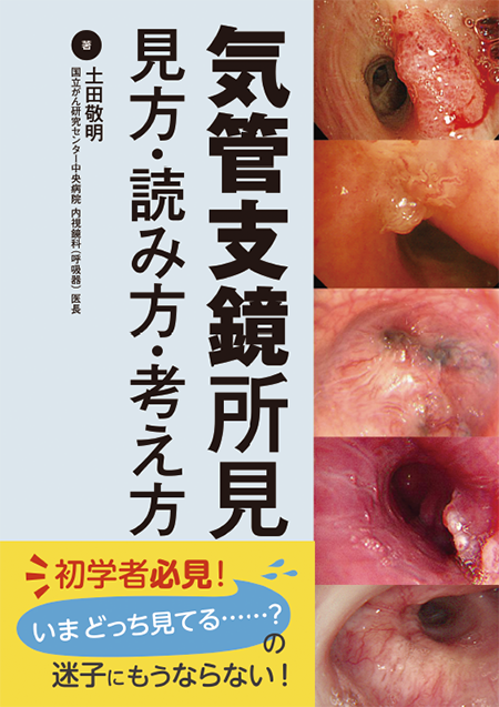 m3電子書籍 | 気管支鏡所見 見方・読み方・考え方