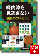 m3電子書籍 | 結膜炎オールラウンド〈専門医のための眼科診療