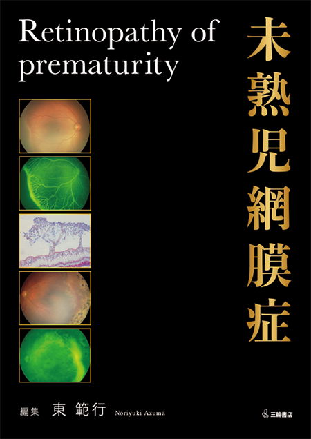 m3電子書籍 | 眼科専門医セルフアセスメント 第3版