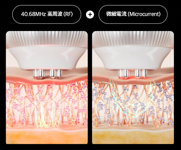 新商品】自宅で体験出来る小顔リフトケアが叶うRF美顔器！『AGE-R