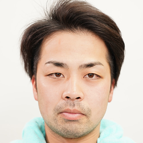 フローレーザーについて | 顔剃りの革命 フローレーザー