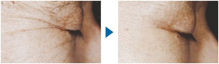 セルクリスタル - エステサロン向け美容機器・基礎化粧品のフレキシア