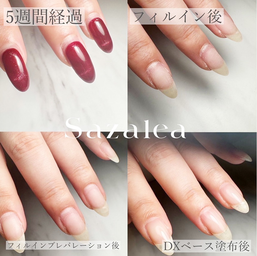 Sazalea アルティメイトDXベースジェル ボトルタイプ | ベースジェル