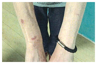 QBケルスター ブレスレット｜トータルヘルスデザイン公式ショップWEB本店