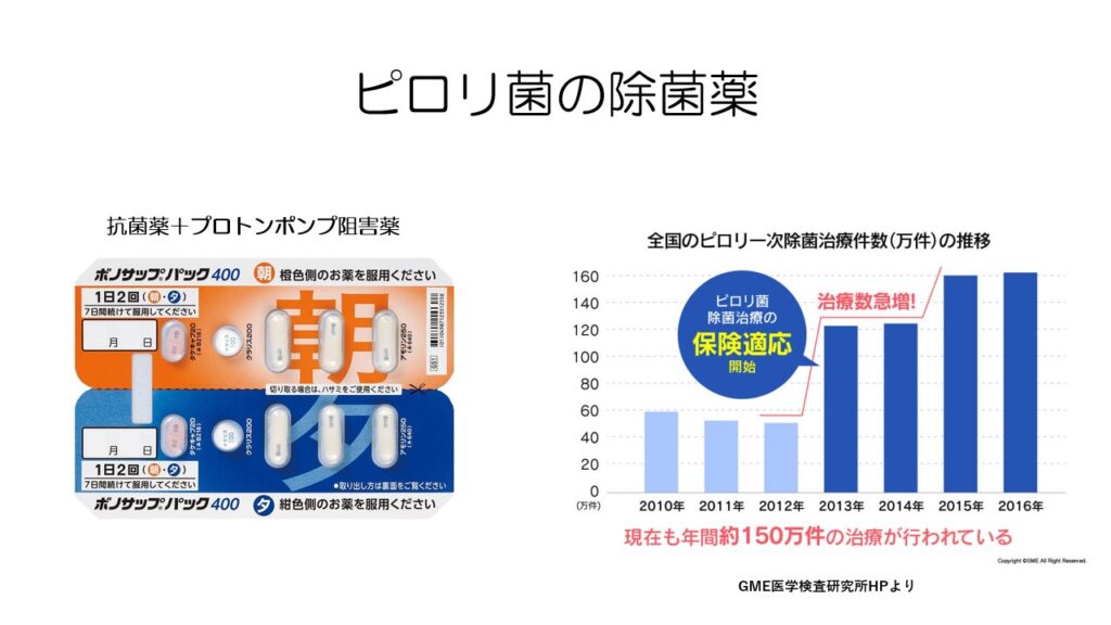 胃がん最新治療を全解説 / 内視鏡手術 / 胃切除術 / ピロリ菌 / 免疫
