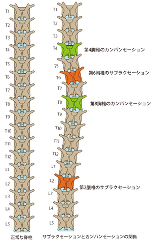 サブラクセーションとは？ – 島田市・静岡市の整体院｜花みずきカイロ
