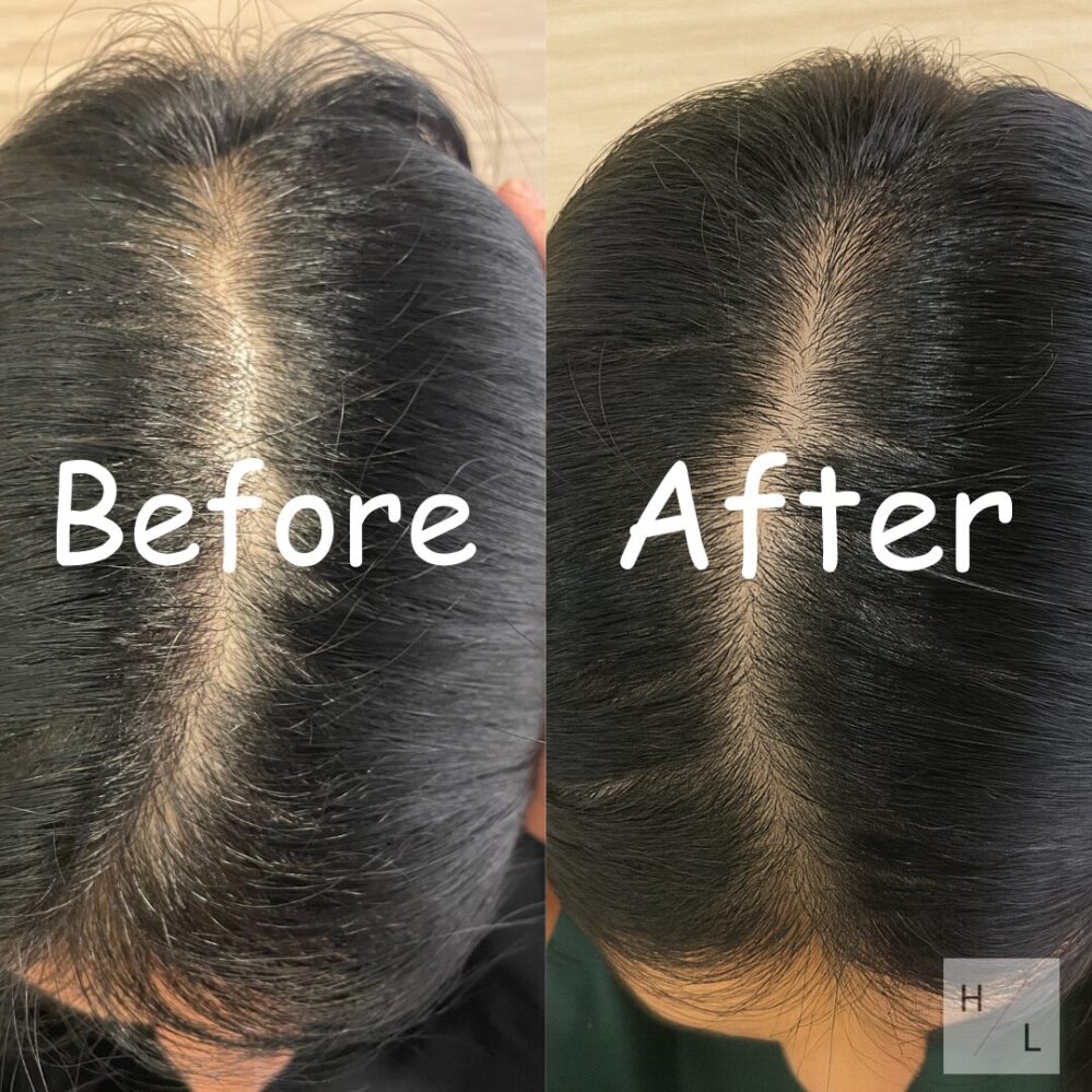 1回で染まる？】KUROクリームシャンプーを美容師が体験レビュー