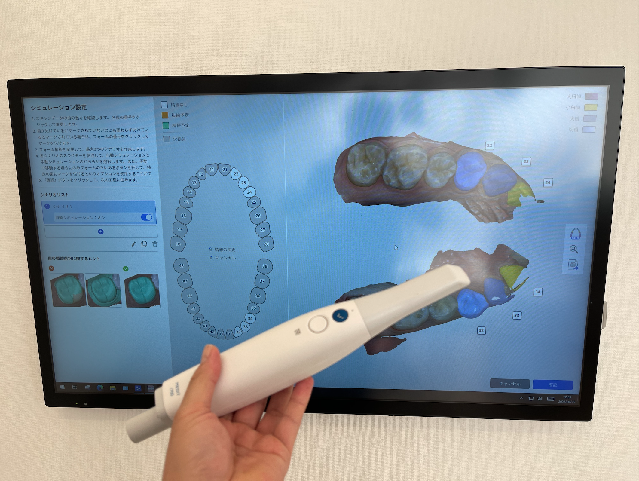 新しい口腔内スキャナが搭載されました Part1 - 医療法人社団徹心会