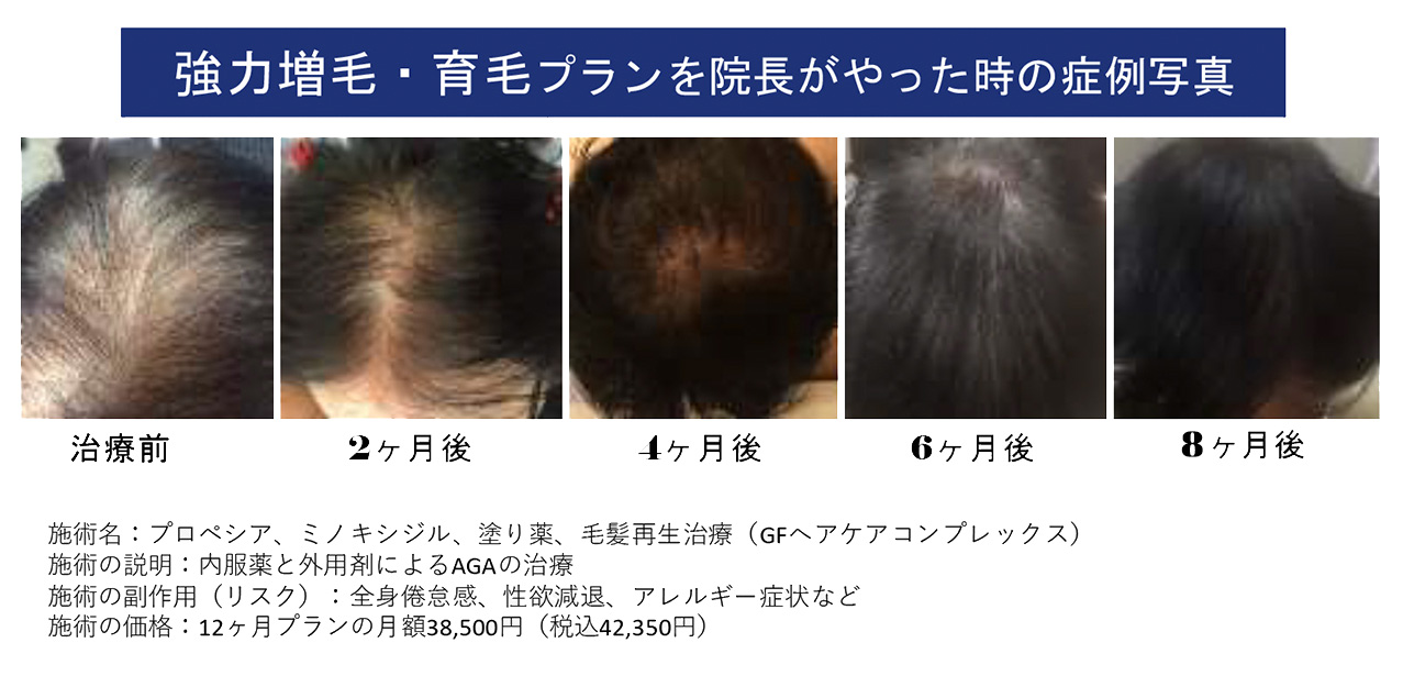 AGA・薄毛・抜け毛治療なら治療経験豊富な形成外科の姫路さくらクリニック