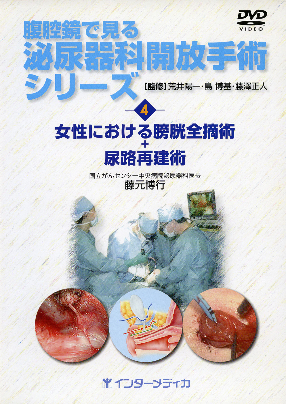 4.女性における膀胱全摘術＋尿路再建術 - インターメディカ 医学・看護