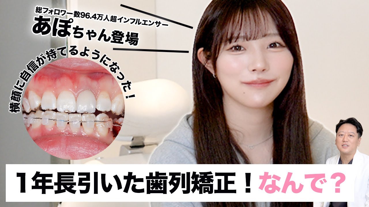24歳女性】カリスマインフルエンサーPKAのあぽちゃん登場！矯正治療が1