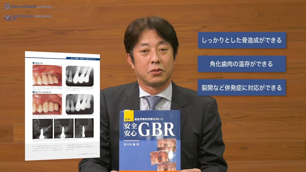 Book Rev.】図解！ 遅延型吸収性膜を用いた 安全安心GBR - YouTube