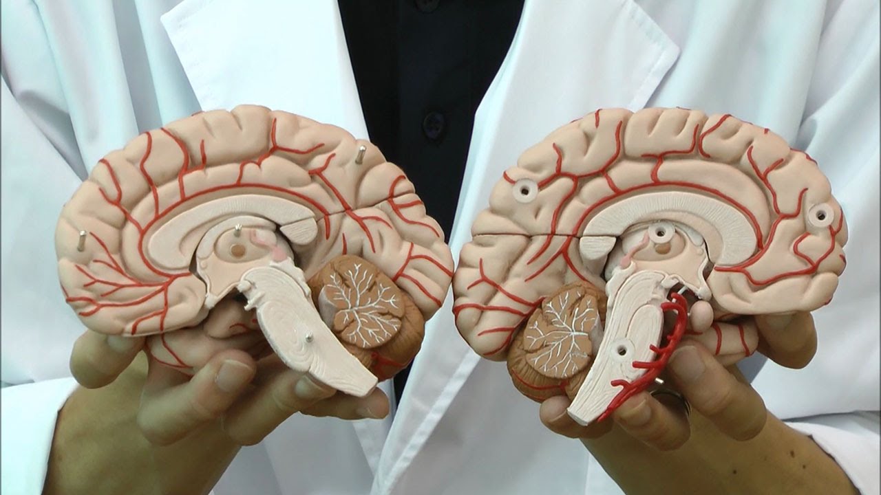 人体模型 脳/動脈付