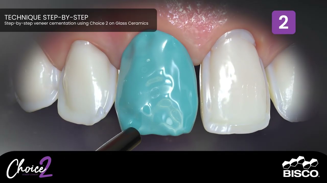 Choice 2™ Try-In Paste Kit | BISCO